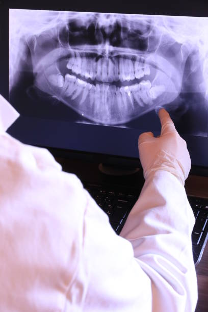 Best Emergency Dental Extractions in Rumson, NJ